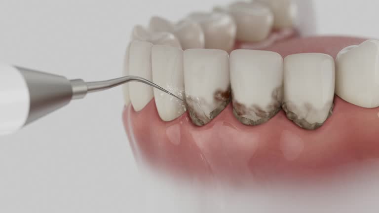 Trusted Emergency Dentist service in Ardmore, PA - Dentist Open Now